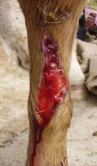 Leg wound Healed with Honey
